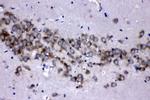 MEK3 Antibody in Immunohistochemistry (Paraffin) (IHC (P))