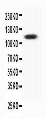 Progesterone Receptor Antibody in Western Blot (WB)