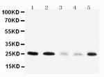 Pleiotrophin Antibody in Western Blot (WB)