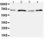 Osteopontin Antibody in Western Blot (WB)