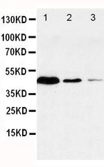 Caspase 1 p20 Antibody in Western Blot (WB)