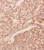 GDNF Antibody in Immunohistochemistry (Paraffin) (IHC (P))