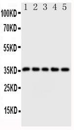 FosB Antibody in Western Blot (WB)