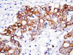 GCLC Antibody in Immunohistochemistry (Paraffin) (IHC (P))