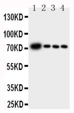 GCLC Antibody in Western Blot (WB)