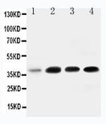 IGFBP3 Antibody in Western Blot (WB)