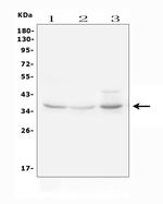 IGFBP3 Antibody in Western Blot (WB)