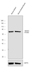 MEKK2 Antibody in Western Blot (WB)