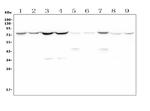 MEKK2 Antibody in Western Blot (WB)