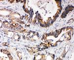 XIAP Antibody in Immunohistochemistry (Paraffin) (IHC (P))