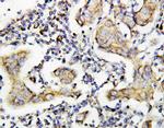 Caspase 8 p10 Antibody in Immunohistochemistry (Paraffin) (IHC (P))