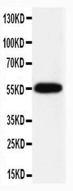 Caspase 8 p10 Antibody in Western Blot (WB)