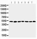 CtBP1 Antibody in Western Blot (WB)