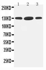 HDAC6 Antibody in Western Blot (WB)