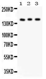 INSR Antibody in Western Blot (WB)