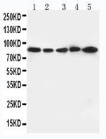 CD18 Antibody in Western Blot (WB)