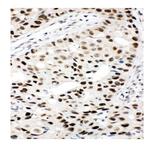 Ku80 Antibody in Immunohistochemistry (Paraffin) (IHC (P))