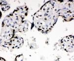 Ku70 Antibody in Immunohistochemistry (Paraffin) (IHC (P))