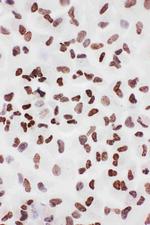 Ku70 Antibody in Immunocytochemistry (ICC/IF)