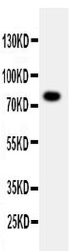 PPP1R15B Antibody in Western Blot (WB)