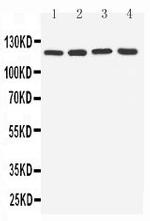 TLR7 Antibody in Western Blot (WB)