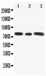 GLI3 Antibody in Western Blot (WB)