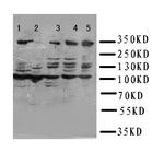 ATM Antibody in Western Blot (WB)