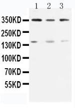 ATM Antibody in Western Blot (WB)