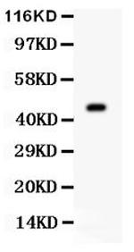 Aurora A Antibody in Western Blot (WB)