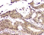 14-3-3 sigma Antibody in Immunohistochemistry (Paraffin) (IHC (P))