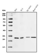 14-3-3 sigma Antibody in Western Blot (WB)