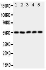 HYAL2 Antibody in Western Blot (WB)