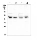 CAR Antibody in Western Blot (WB)