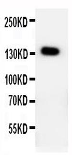 PTCH2 Antibody in Western Blot (WB)