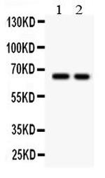 TGFBR2 Antibody in Western Blot (WB)