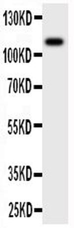 CSF1R Antibody in Western Blot (WB)