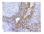 SQSTM1 Antibody in Immunohistochemistry (Paraffin) (IHC (P))