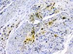 SQSTM1 Antibody in Immunohistochemistry (Paraffin) (IHC (P))