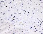 ZEB2 Antibody in Immunohistochemistry (Paraffin) (IHC (P))