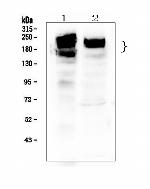 ZEB2 Antibody in Western Blot (WB)