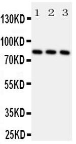 RSK1 Antibody in Western Blot (WB)