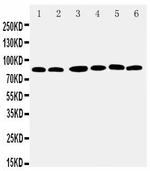 RSK1 Antibody in Western Blot (WB)