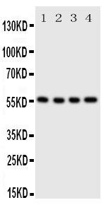 SLC2A5 Antibody in Western Blot (WB)