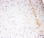 ALDH2 Antibody in Immunohistochemistry (Paraffin) (IHC (P))