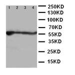 ALDH2 Antibody in Western Blot (WB)