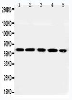 RGS14 Antibody in Western Blot (WB)