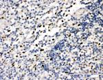 FLI1 Antibody in Immunohistochemistry (Paraffin) (IHC (P))