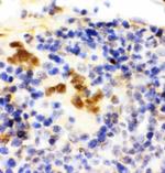 FLI1 Antibody in Immunohistochemistry (Paraffin) (IHC (P))