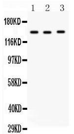 ACE Antibody in Western Blot (WB)