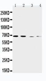 SLC7A1 Antibody in Western Blot (WB)